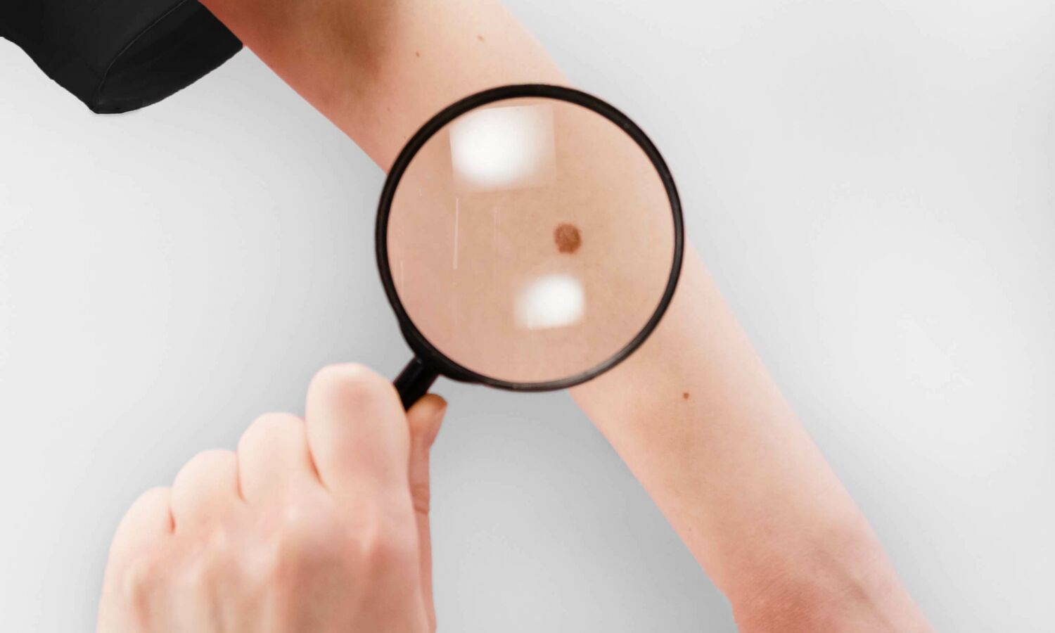 Blog 14 Huidtherapeut Groenlo YESS Huidtherapie herken huidkanker