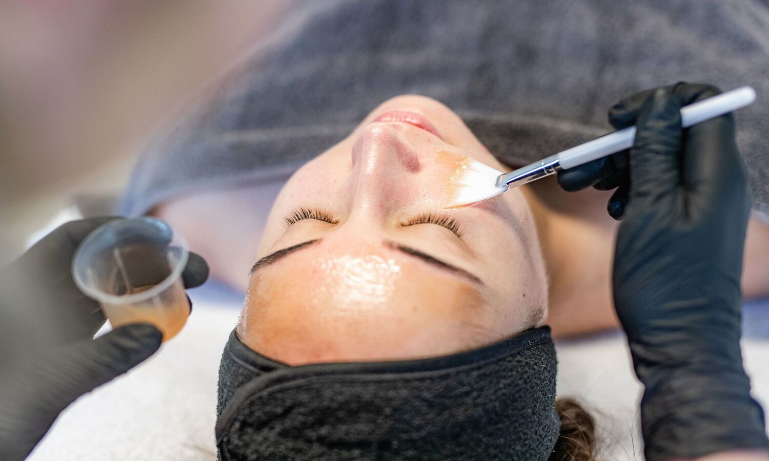 Blog 23 Huidtherapeut Groenlo YESS Huidtherapie huidbehandeling