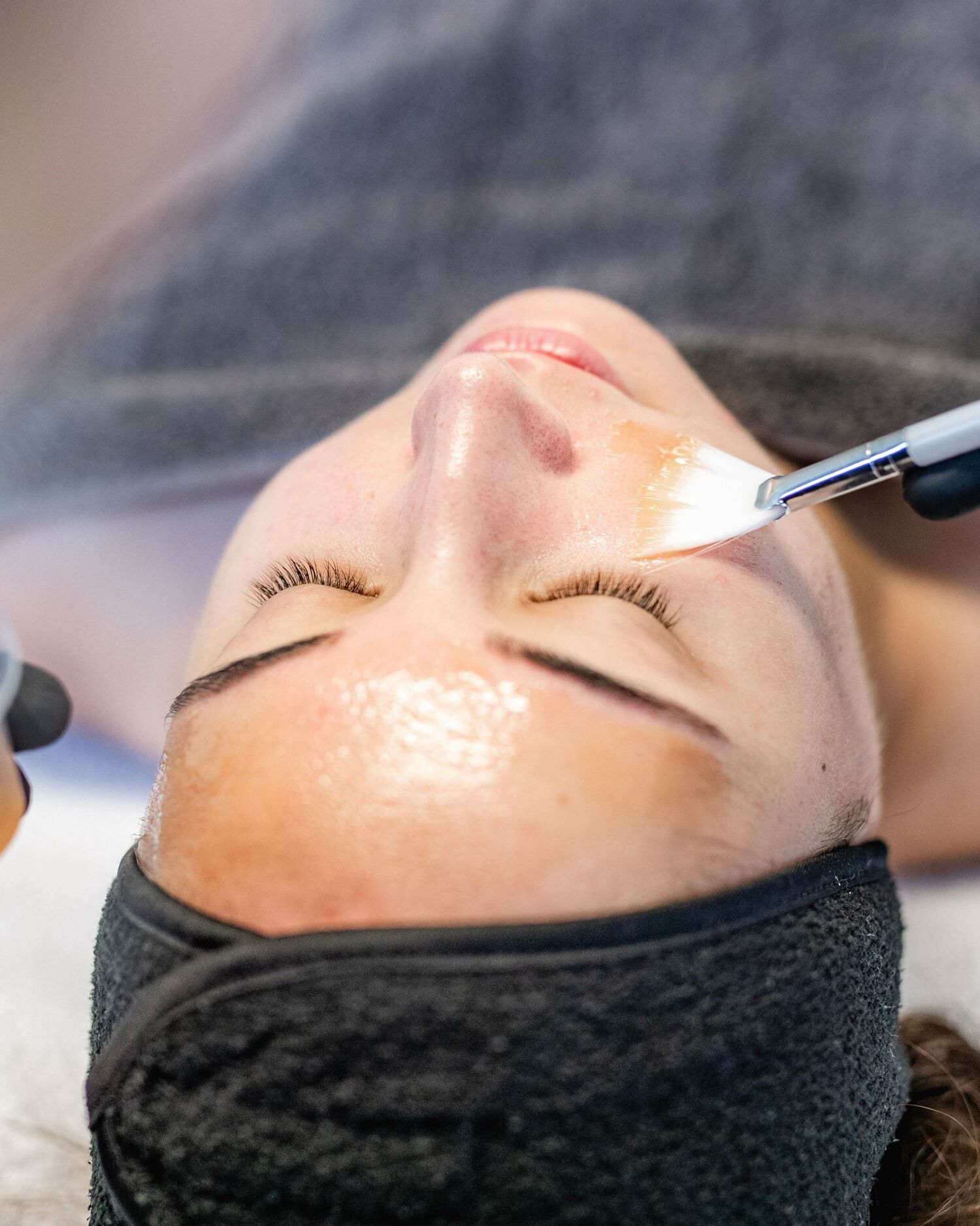 Blog 23 Huidtherapeut Groenlo YESS Huidtherapie huidbehandeling