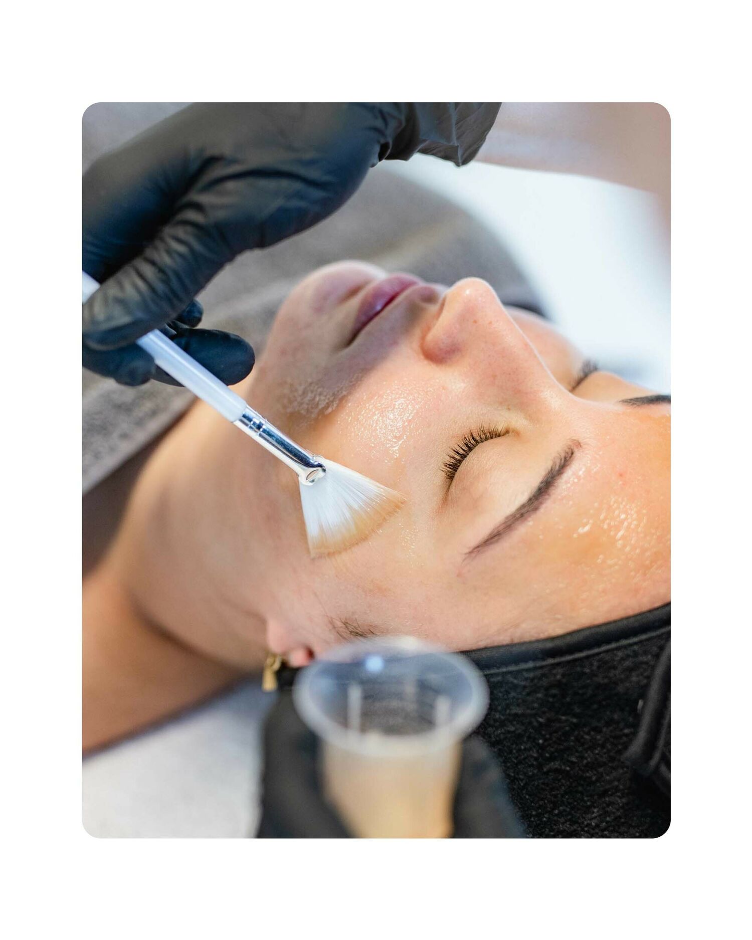 Huidtherapie Groenlo YESS 08