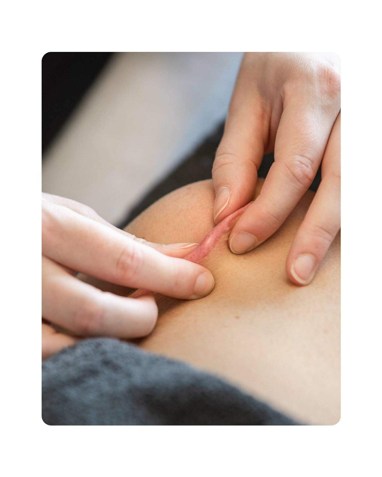 Huidtherapie Groenlo YESS 19