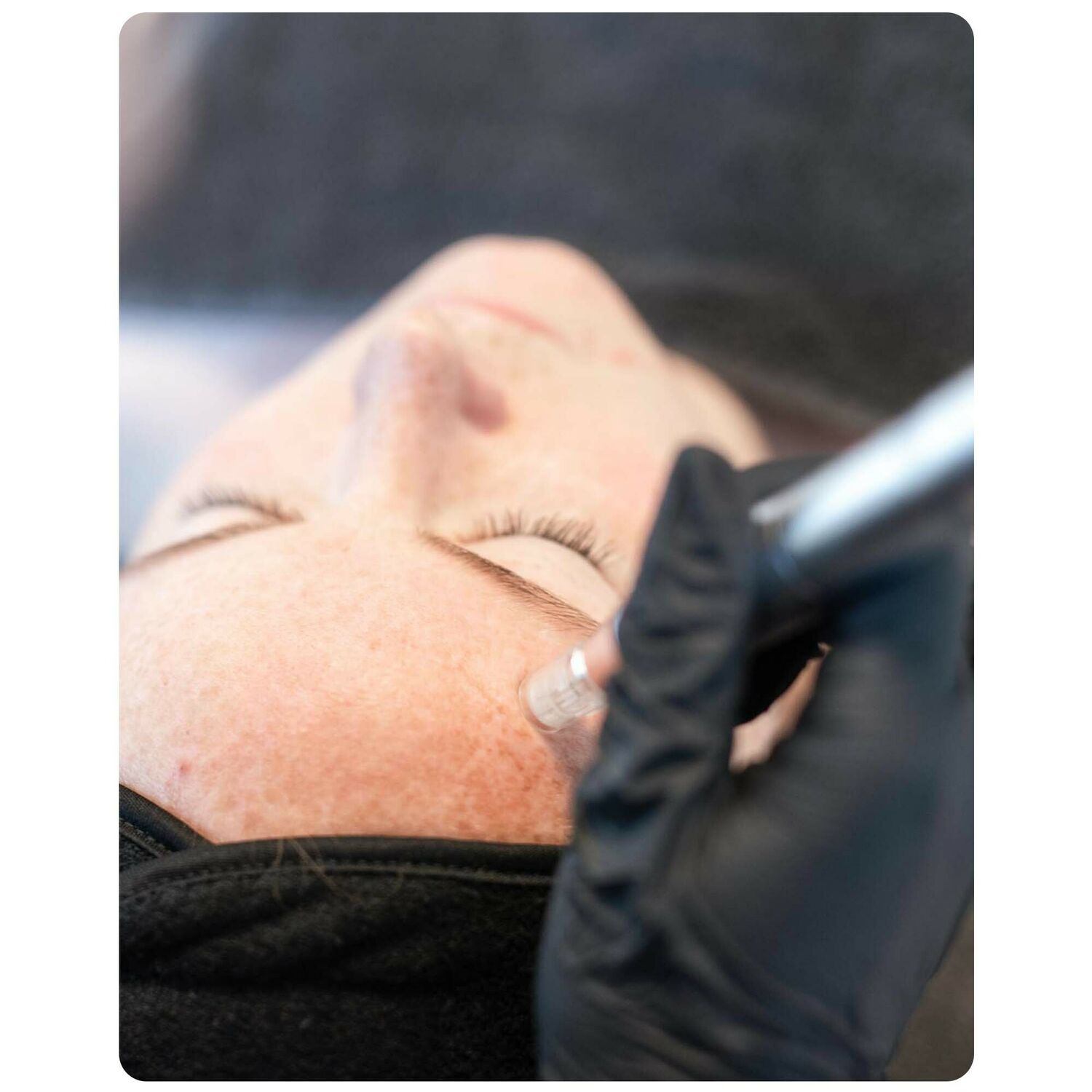 Huidtherapie Groenlo YESS 21