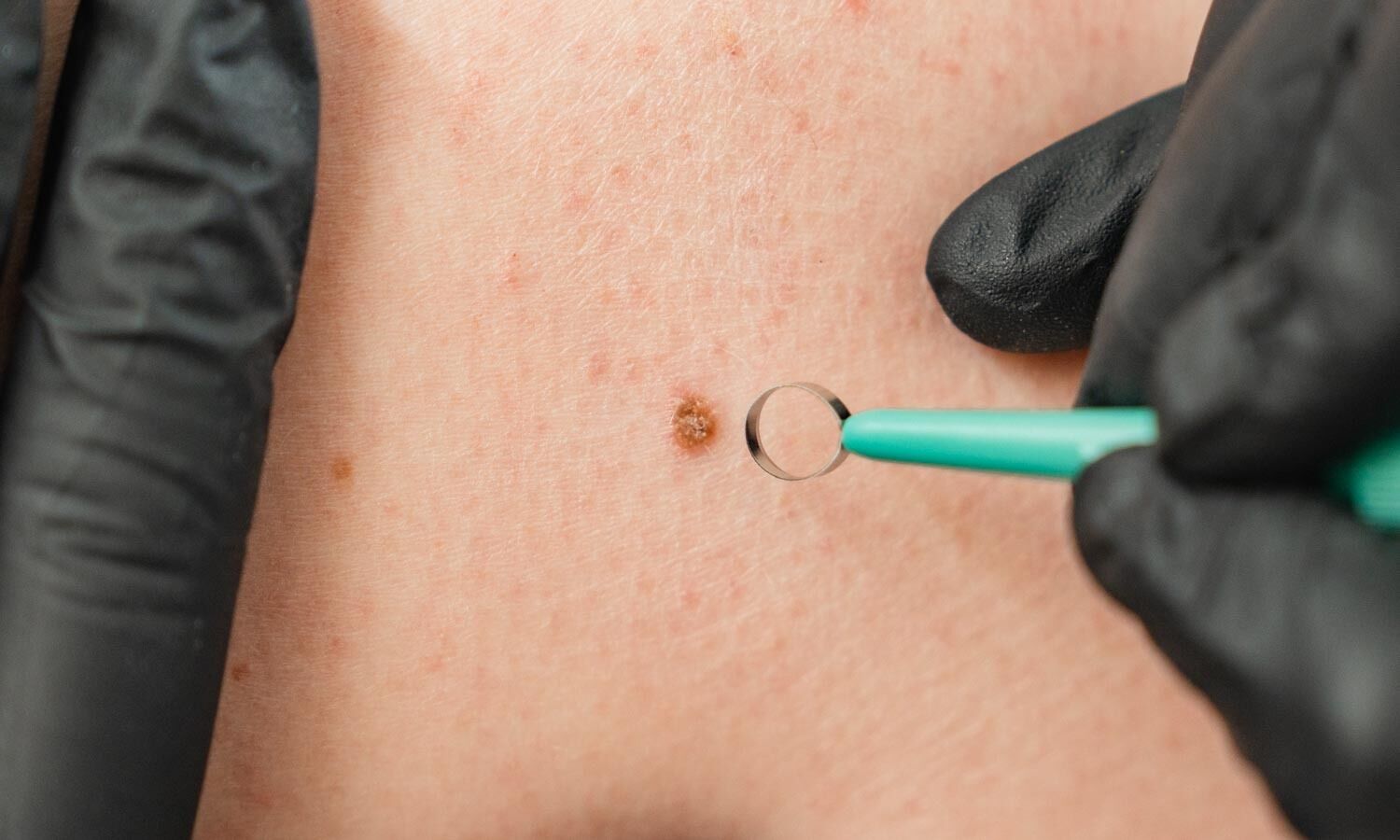 Huidtherapie Groenlo Review 01