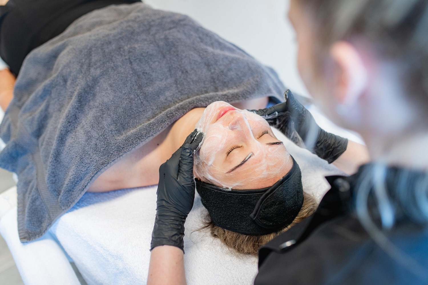 Acne behandeling Groenlo 01