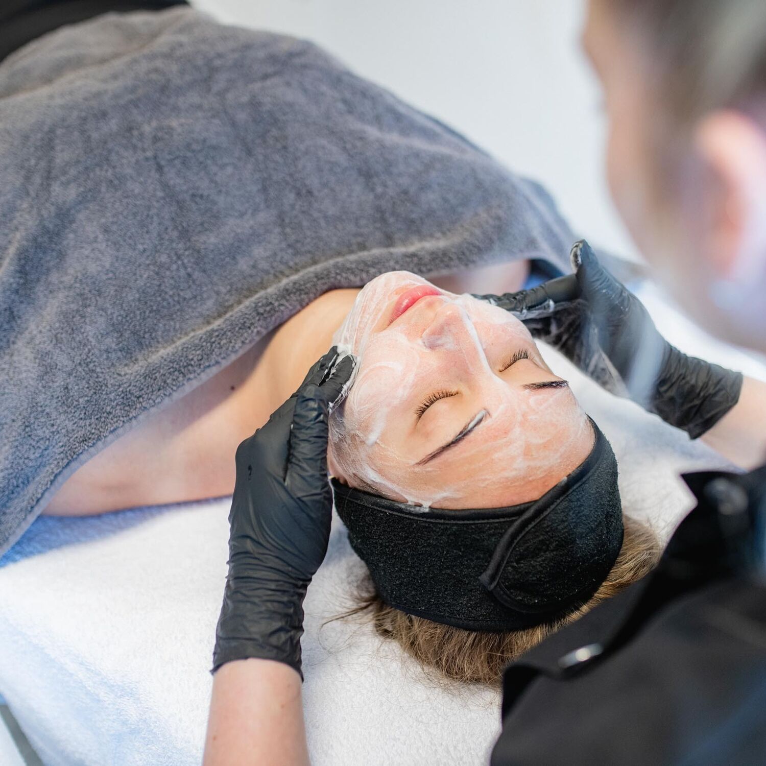 Acne behandeling Groenlo 01