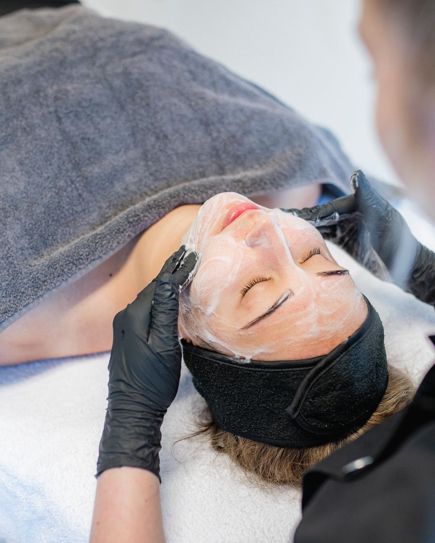 Acne behandeling Groenlo 01