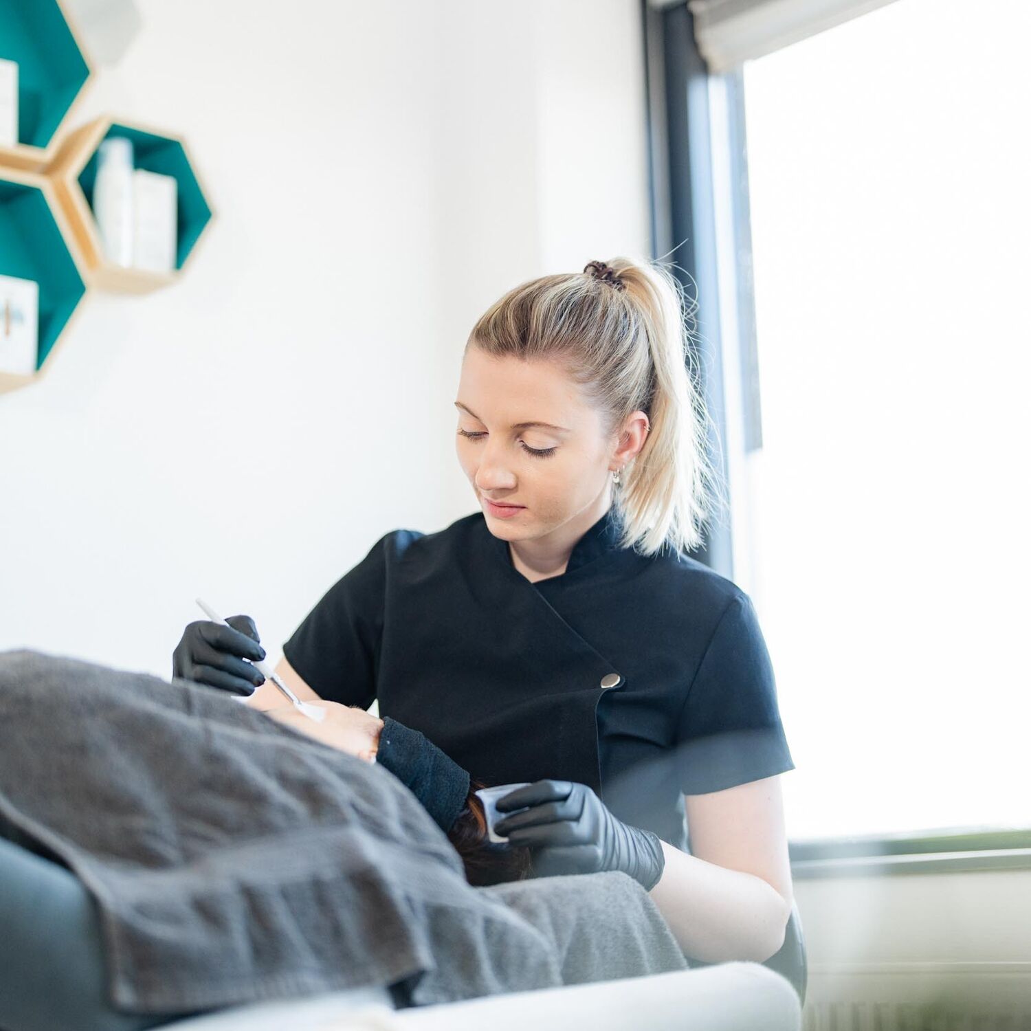 Chemische Peeling Acne Behandeling Groenlo 01