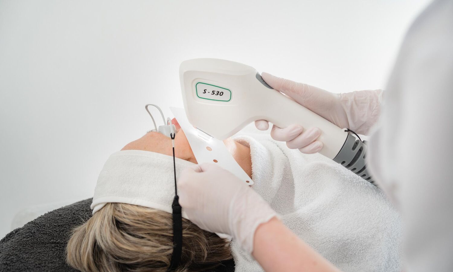 IPL Behandeling Groenlo 01