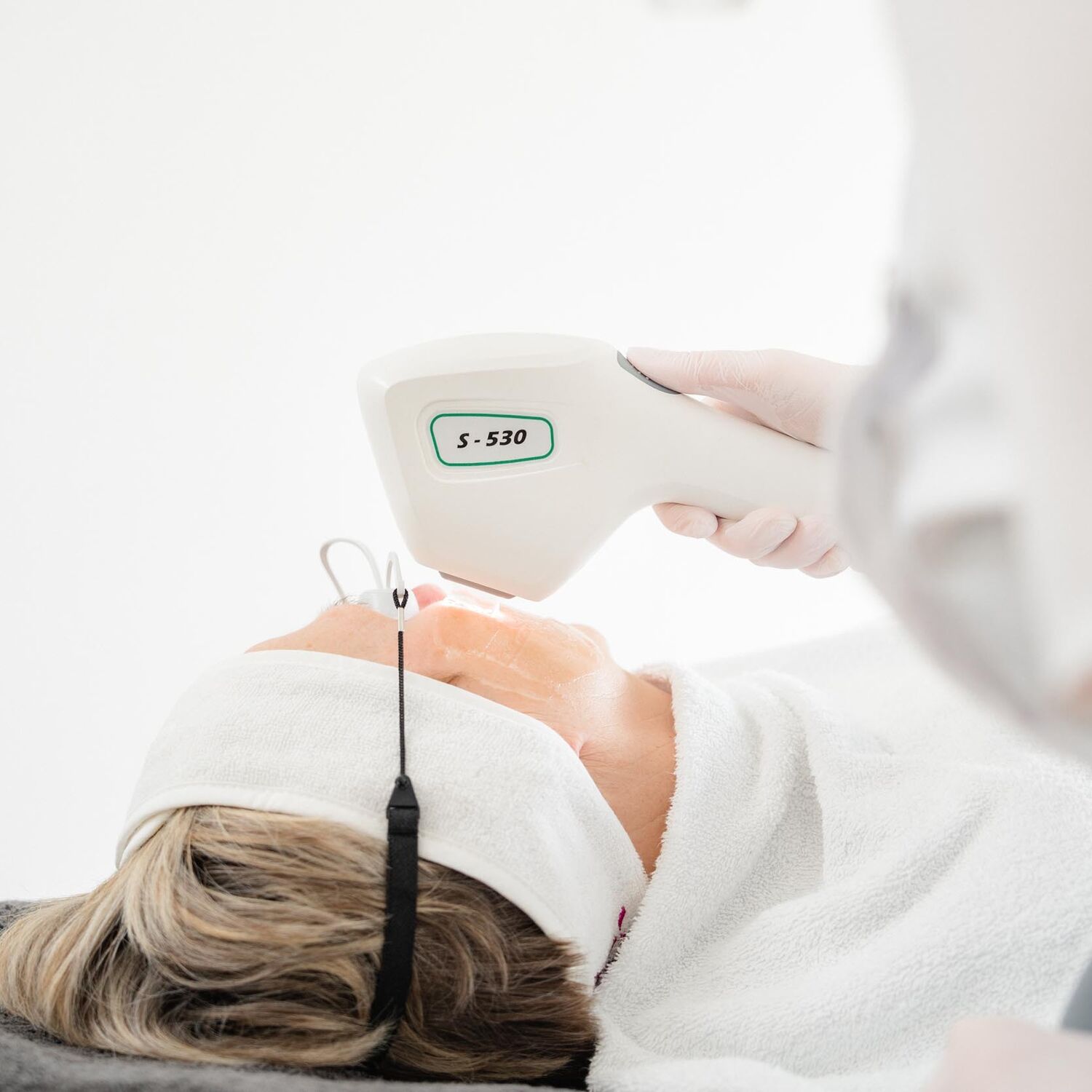 IPL Behandeling Groenlo 03