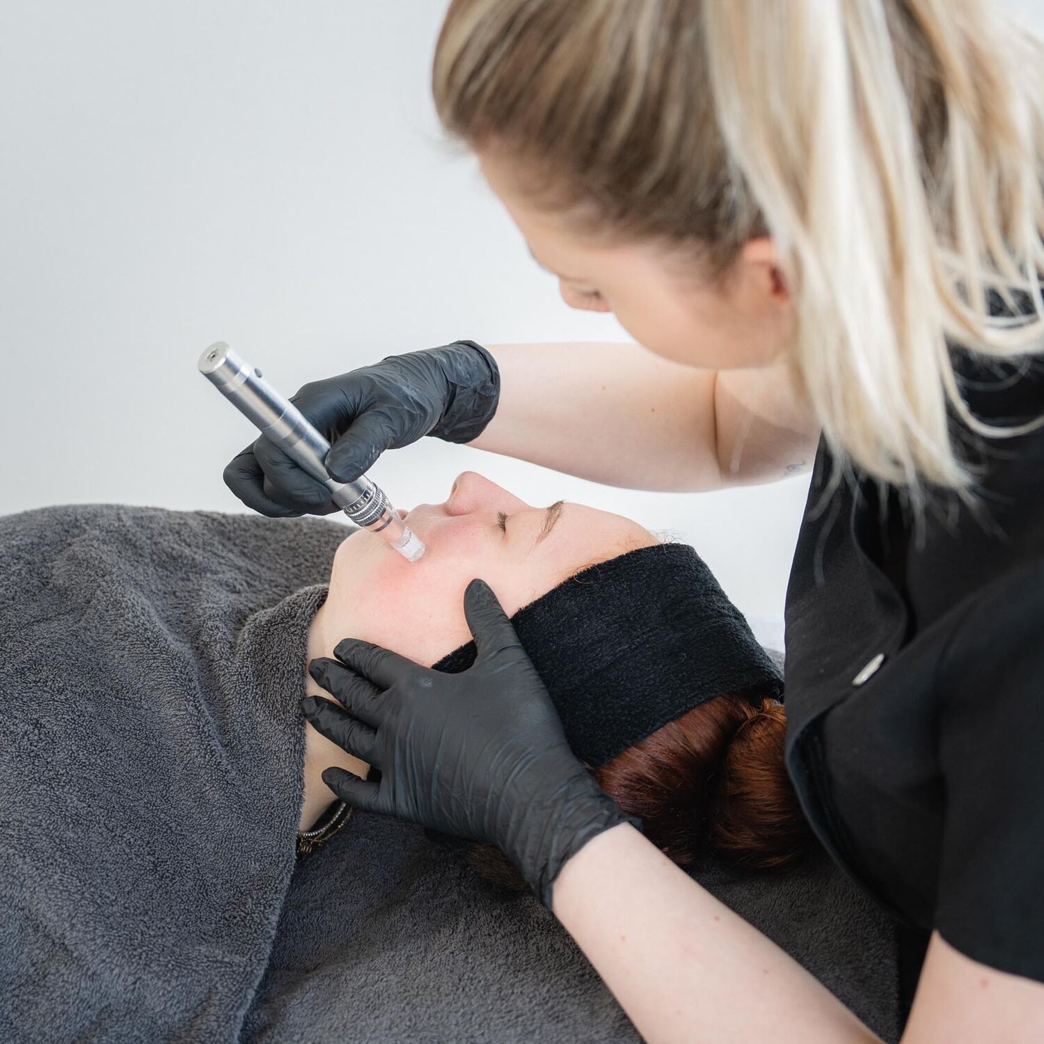 Microneedling Behandeling Groenlo 01