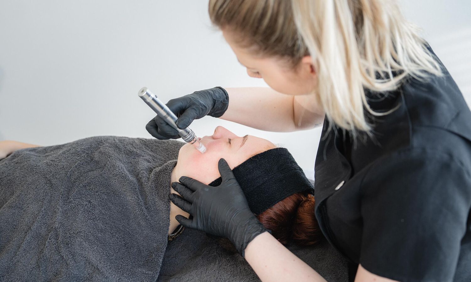 Microneedling Behandeling Groenlo 01