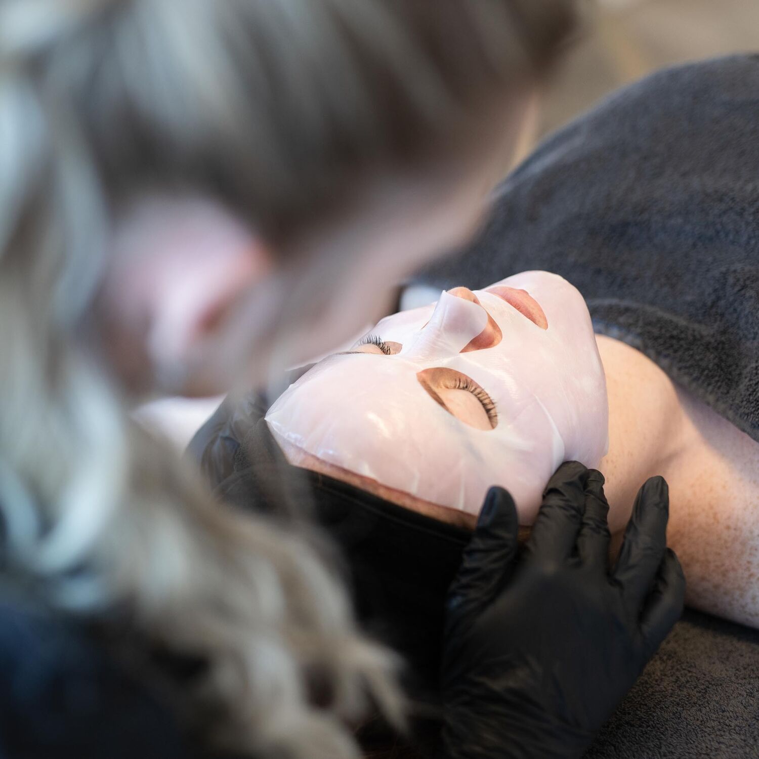 Microneedling Behandeling Groenlo 06