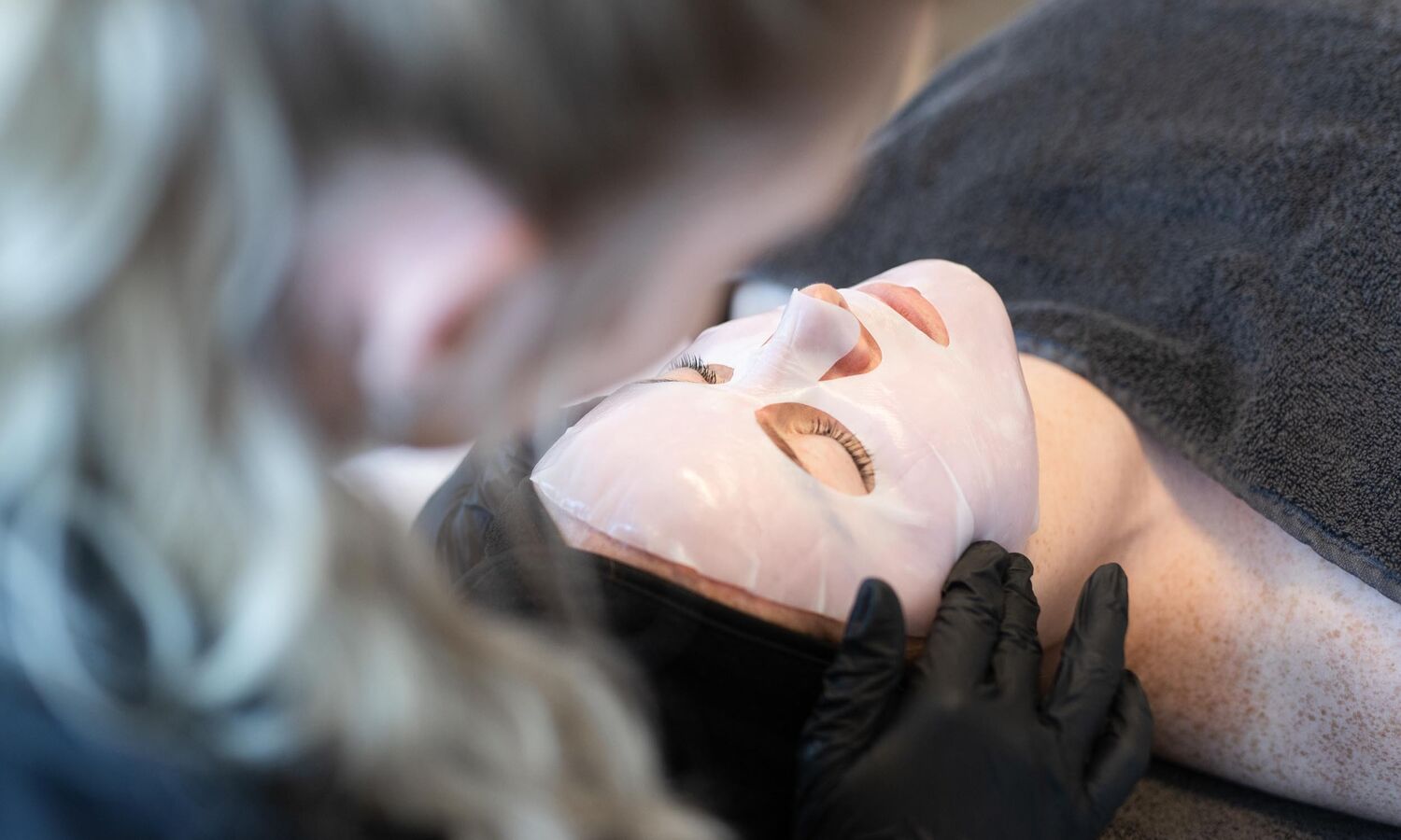 Microneedling Behandeling Groenlo 06