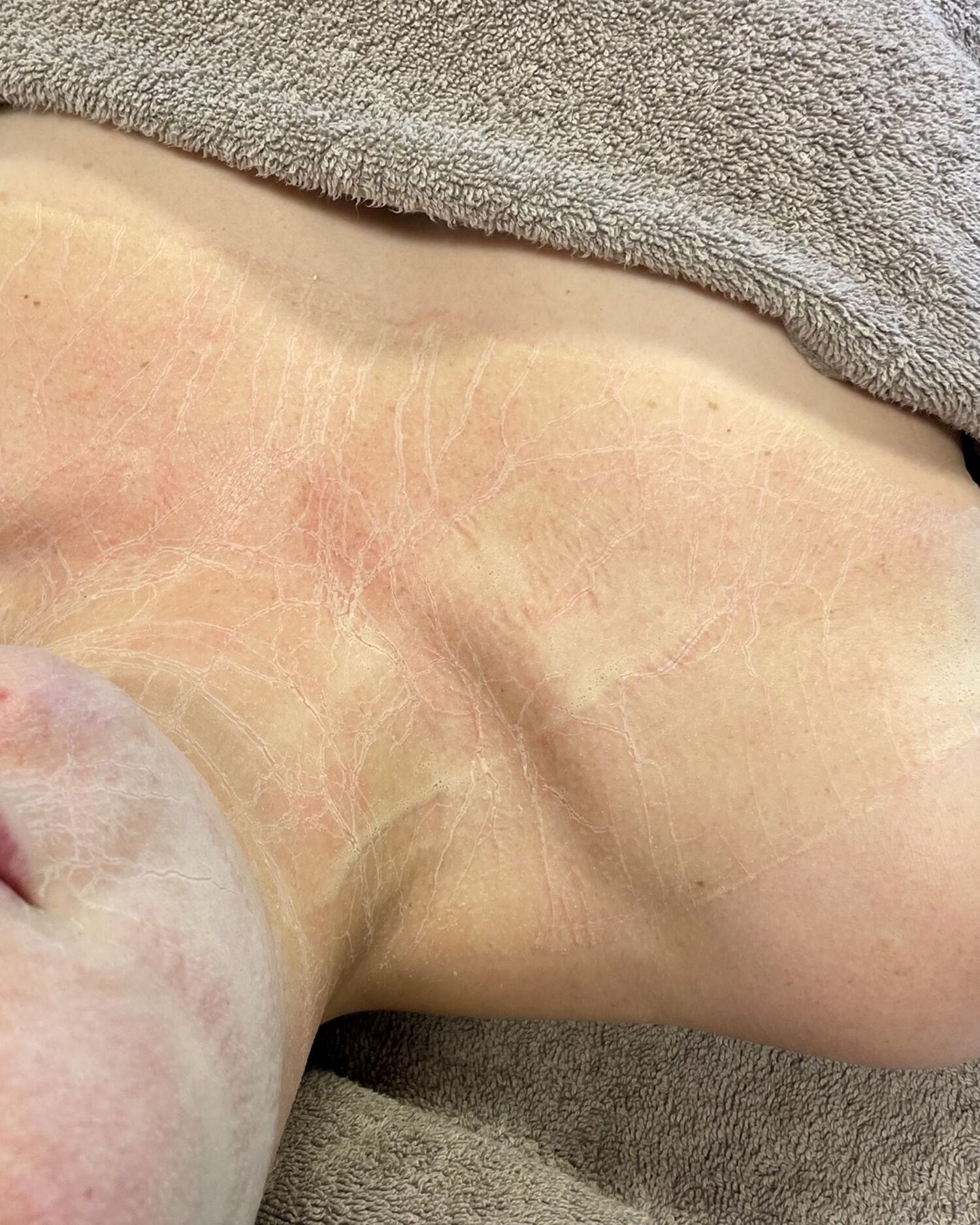 YES Slymfatischeterapie2